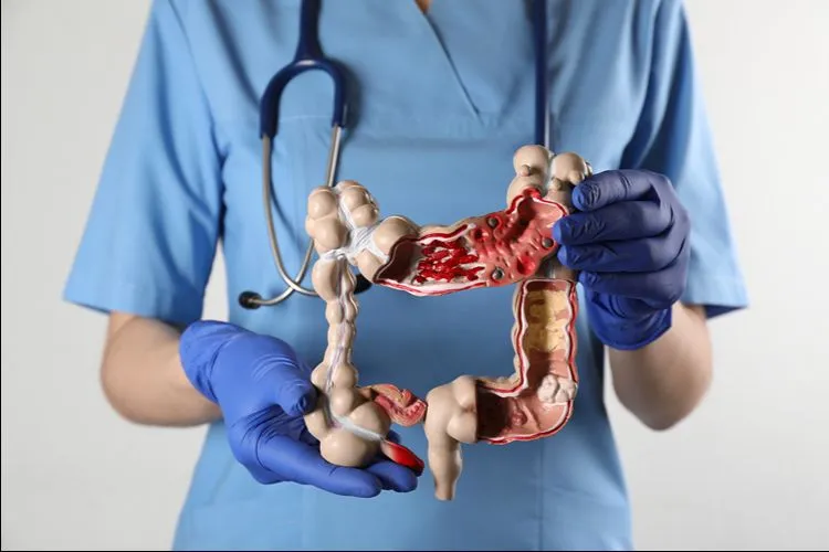 Medical professional with colon anatomy model — low Akkermansia is associated with gut barrier compromise and multiple health conditions